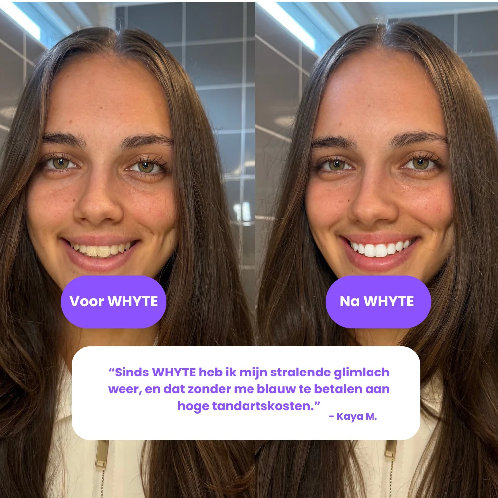 Customer Kaya before and after the WHYTE whitening treatment